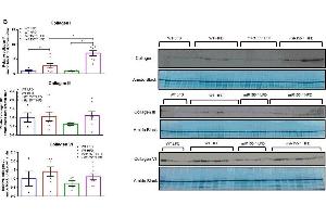 miR155 deletion increases adipose tissue fibrosis under high-fat diet (HFD) conditions in male mice.