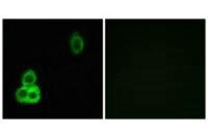Immunofluorescence analysis of MCF-7 cells, using CELSR1 antibody. (CELSR1 anticorps)