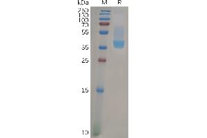 Human C Protein, hFc Tag on SDS-PAGE under reducing condition.