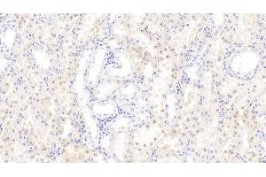 Detection of GABARAPL2 in Human Kidney Tissue using Polyclonal Antibody to GABA-A Receptor Associated Protein Like Protein 2 (GABARAPL2)
