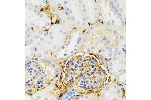 Immunohistochemistry of paraffin-embedded mouse kidney using GALT antibody. (GALT anticorps)