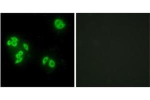 Immunofluorescence analysis of A549 cells, using TFIP8 Antibody  . (TNFAIP8 anticorps)