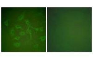Immunofluorescence analysis of HepG2 cells, using Mammaglobin antibody.