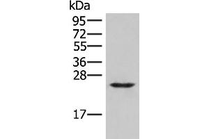 Western blot analysis of Human fetal brain tissue lysate using MRAS Polyclonal Antibody at dilution of 1:400 (MRAS anticorps)
