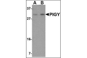Western blot analysis of PIG-Y in human spleen tissue lysate with this product at (A) 1 and (B) 2 μg/ml.