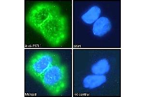 ABIN184815 Immunofluorescence analysis of paraformaldehyde fixed A431 cells, permeabilized with 0.