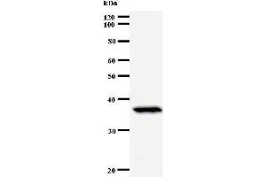 Western Blotting (WB) image for anti-Paired Box 6 (PAX6) antibody (ABIN930925) (PAX6 anticorps)