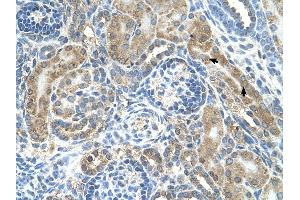 CRELD1 antibody was used for immunohistochemistry at a concentration of 4-8 ug/ml to stain Epithelial cells of renal tubule (arrows) in Human Kidney. (CRELD1 anticorps  (C-Term))