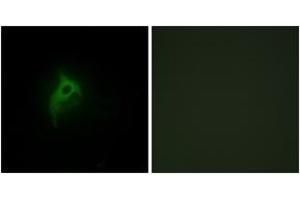Immunofluorescence analysis of HepG2 cells, using Adrenergic Receptor alpha-2B Antibody.