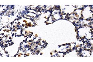 Detection of IL1R1 in Rat Lung Tissue using Polyclonal Antibody to Interleukin 1 Receptor Type I (IL1R1)