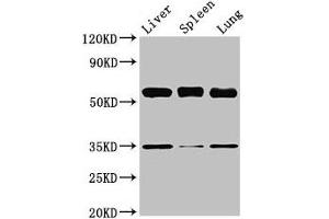 Western Blot Positive WB detected in: Mouse liver tissue, Mouse spleen tissue, Mouse lung tissue All lanes: Gba antibody at 3. (GBA anticorps  (AA 20-515))