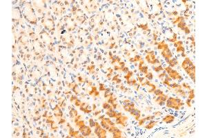 ABIN6267237 at 1/100 staining rat gastric tissue sections by IHC-P.