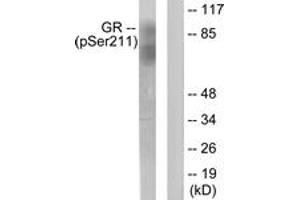 Western blot analysis of extracts from HeLa cells treated with Heat shock, using GR (Phospho-Ser211) Antibody. (GR (AA 181-230), (pSer211) anticorps)