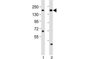 Western blot testing of Kdm6a antibody at 1:2000 dilution. (KDM6A anticorps  (C-Term))