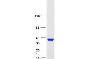 Validation with Western Blot