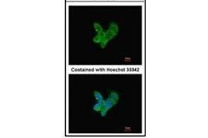 Immunofluorescence analysis of methanol-fixed HepG2, using Complement C9 antibody at 1/200 dilution. (C9 anticorps)