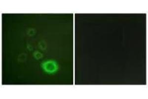 Immunofluorescence analysis of A549 cells, using c-Met (Ab-1003) antibody.