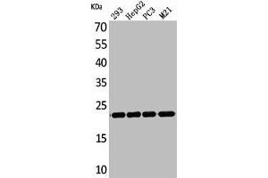 Western Blot analysis of 293 HepG2 PC-3 M21 cells using FGF-6 Polyclonal Antibody (FGF6 anticorps  (C-Term))