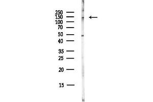 Western blot analysis of lysates from COLO205 cells(heat-shock,45 min treatment), using Liprin alpha 2 Antibody at 1/1000 dilution.