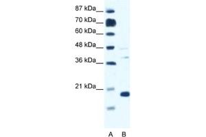 Western Blotting (WB) image for anti-Calcium Channel, Voltage-Dependent, gamma Subunit 1 (CACNG1) antibody (ABIN2461569) (CACNG1 anticorps)