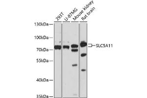 Western blot analysis of extracts of various cell lines, using SLC5 antibody (ABIN6127283, ABIN6148021, ABIN6148022 and ABIN6217058) at 1:3000 dilution. (Solute Carrier Family 5 (Sodium/inositol Cotransporter), Member 11 (SLC5A11) (AA 540-640) anticorps)