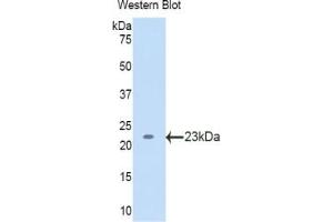 Western blot analysis of the recombinant protein. (LCAT anticorps  (AA 41-210))