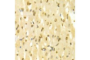 Immunohistochemistry of paraffin-embedded Rat heart using LMNB1 antibody at dilution of 1:100 (x400 lens). (Lamin B1 anticorps  (AA 397-586))