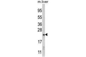Western blot analysis of NQO2 Antibody (Center) in mouse liver tissue lysates (35ug/lane). (NQO2 anticorps  (Middle Region))