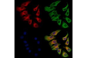 ABIN6263049 and ABIN6273132 staining Hela cells by IF/ICC. (MAD2L2 anticorps  (Internal Region))