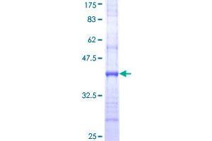 Image no. 1 for Solute Carrier Family 15 (Oligopeptide Transporter), Member 1 (SLC15A1) (AA 473-572) protein (GST tag) (ABIN1320146)