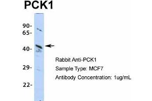 Host:  Rabbit  Target Name:  PCK1  Sample Type:  MCF7  Antibody Dilution:  1.