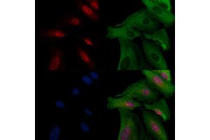 ABIN6257271 and ABIN6274269 staining  cells by IF/ICC. (MEOX2 anticorps  (Internal Region))