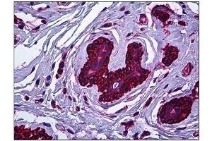 Immunohistochemistry (IHC) image for anti-Myosin 9 (MYH9) antibody (ABIN782310)
