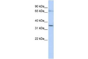 Western Blotting (WB) image for anti-Solute Carrier Organic Anion Transporter Family, Member 1C1 (SLCO1C1) antibody (ABIN2458796) (SLCO1C1 anticorps)