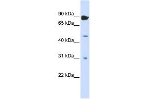 ADARB1 antibody used at 1 ug/ml to detect target protein. (RED1 anticorps)
