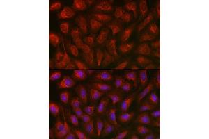 Immunofluorescence analysis of U2OS cells using TXNIP antibody (ABIN6130776, ABIN6149733, ABIN6149734 and ABIN6224986) at dilution of 1:100.