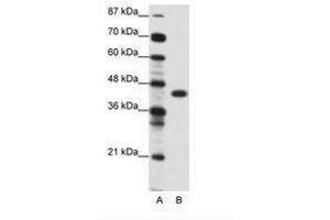 Image no. 1 for anti-Zinc Finger Protein 396 (ZNF396) (AA 181-230) antibody (ABIN6736117) (ZNF396 anticorps  (AA 181-230))