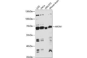 Western blot analysis of extracts of various cell lines, using  antibody (ABIN7265658) at 1:1000 dilution.
