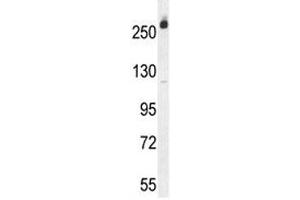 CAD antibody western blot analysis in Jurkat lysate.