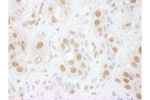 Immunohistochemistry (IHC) image for anti-hPrp3p (AA 100-150) antibody (ABIN7448600) (hPrp3p (AA 100-150) anticorps)