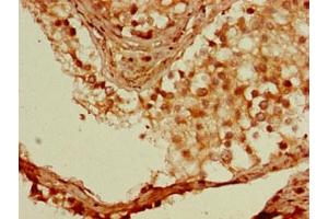 Immunohistochemistry of paraffin-embedded human testis tissue using ABIN7166156 at dilution of 1:100 (SSX1 anticorps  (AA 112-188))