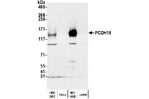 anti-Protocadherin 19 (PCDH19) (AA 1098-1148) antibody