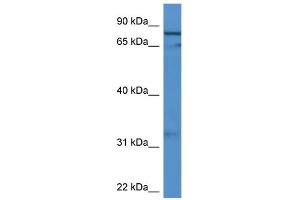 WB Suggested Anti-GFM2 Antibody Titration: 0. (GFM2 anticorps  (C-Term))