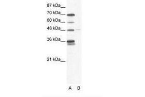 Image no. 1 for anti-GLIS Family Zinc Finger 2 (GLIS2) (AA 83-132) antibody (ABIN202714) (GLIS2 anticorps  (AA 83-132))