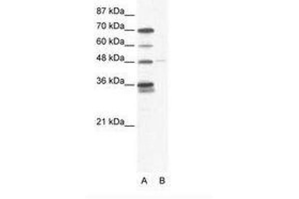 GLIS2 Antikörper  (AA 83-132)
