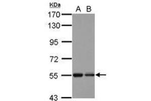 Image no. 1 for anti-Kelch Repeat and BTB (POZ) Domain Containing 4 (KBTBD4) (AA 287-518) antibody (ABIN1501896) (KBTBD4 anticorps  (AA 287-518))