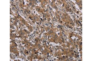 Immunohistochemistry (IHC) image for anti-Myelin and Lymphocyte Protein, T Cell Differentiation Protein (MAL) antibody (ABIN2433347)