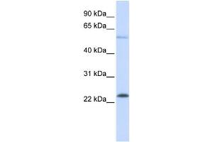 Western Blotting (WB) image for anti-GTPase Kras (KRAS) antibody (ABIN2459898) (K-RAS anticorps)