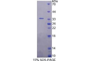 Image no. 1 for Interleukin 20 Receptor alpha (IL20RA) (AA 273-543) protein (His tag) (ABIN6238127) (IL20RA Protein (AA 273-543) (His tag))