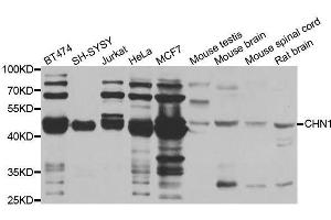 Western blot analysis of extracts of various cell lines, using CHN1 antibody. (CHN1 anticorps  (AA 1-200))